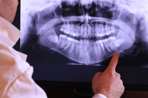 Best Emergency Dentist for Special Needs Patients in Keshore, LA