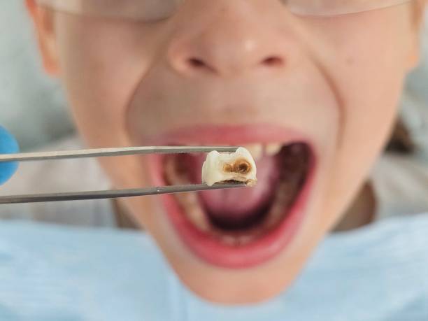Best Emergency Dental Services for Seniors in Keshore, LA