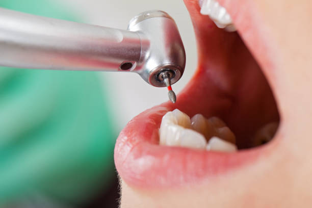 Best Mobile Emergency Dentist in Keshore, LA